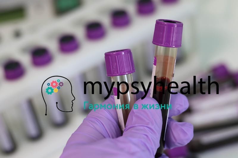 Тест крови Альцгеймера - шанс обнаружить болезнь | Mypsyhealth